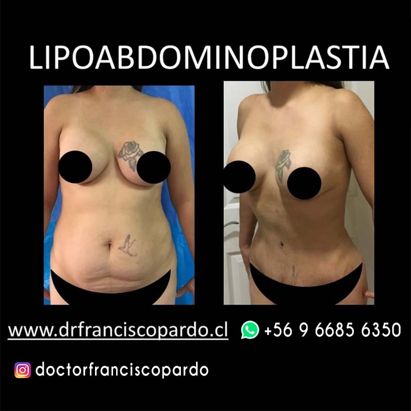 Cirugía Estética